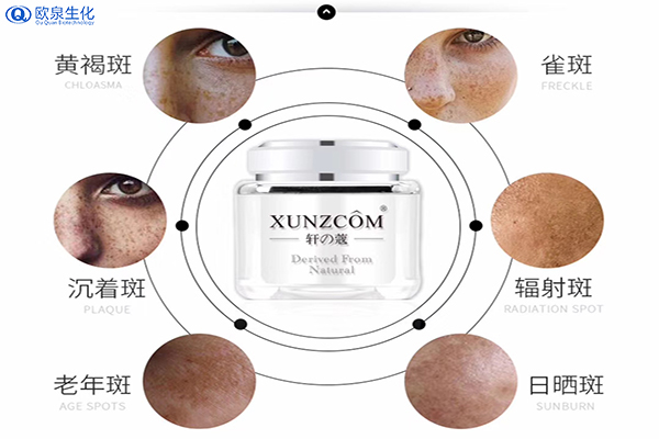 臉上長斑原因及祛斑該用的產(chǎn)品-歐泉生化 臉上長斑原因及祛斑該用的產(chǎn)品-歐泉生化
